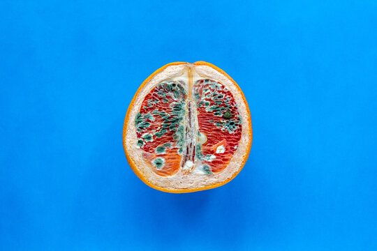 The concept of vaginal disease: venereal diseases, Vaginal yeast infection, Syphilis. Orange with mold on blue background