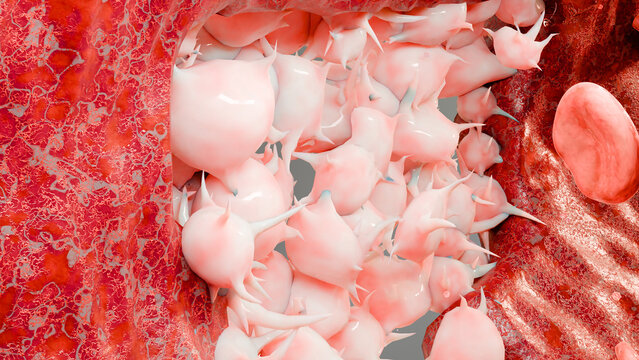 Hemostasis. Red blood cells and platelets in the blood vessel, vasoconstriction, wound healing process. hemorrhage clot embolisms, Hemophilia. fibrinolysis, injury bleeding coagulation, 3d render