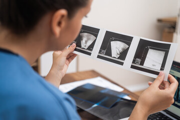 IVF Ultrasound Examination: close up doctor scrutinizes ultrasound results, recording detailed notes on her laptop  - obrazy, fototapety, plakaty