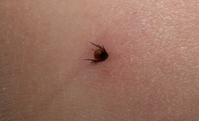 Ixodes ricinus, the castor bean tick. The parasite during the bite. Carrier Lyme disease and...