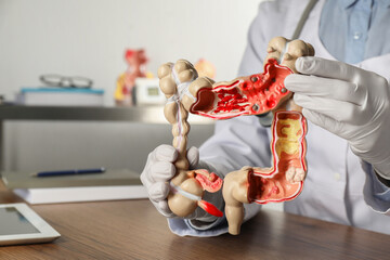 Gastroenterologist with human colon model at table in clinic, closeup