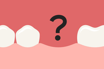 Row of teeth with one tooth missing and question mark