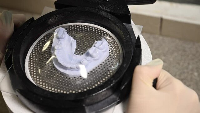 Mouth guard for teeth, printed on a 3D printer in dental clinic laboratory. 4k cinematic slow motion video