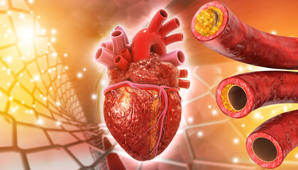 Human heart with Clogged arteries on scientific background. 3d illustration..