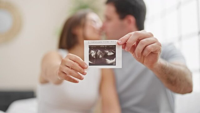 Beautiful couple holding baby ultrasound kissing at bedroom
