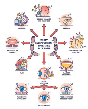Early symptoms of multiple sclerosis and MS affected things outline diagram. Labeled educational medical scheme with potential problems after diagnosed illness or body condition vector illustration.