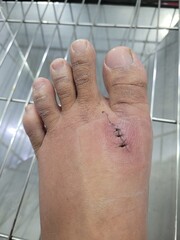 The wounds on the foot have already been sewn.
