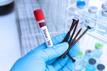 Tetanus test to look for abnormalities from blood