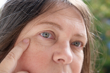 Aging Gracefully, Close-up female Eyes with Wrinkles, Embracing Aging concept, Sarcasm gesture,...