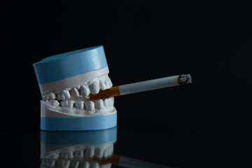 Plaster model of the jaw with a cigarette on a black background.