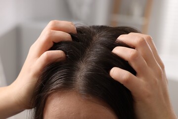 Woman examining her hair and scalp on blurred background, closeup