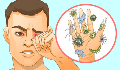 Inflammation of the eyes. Eye irritation. Allergy. Conjunctivitis, stye. Do not touch your eyes with dirty hands. Healthcare illustration. Vector illustration. - obrazy, fototapety, plakaty