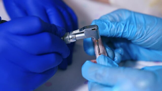 Two pairs of hands in latex gloves holding drill machine and bone. Drill is used to make a hole and red liquid appears. Close up.