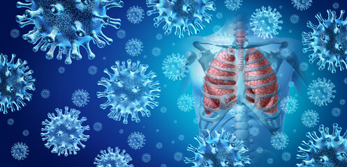 Respiratory Pneumonia Outbreak as Virus pathogen spreading as a Lung Infection and infections as an inflammation disease as influenza flu outbreak or pulmonary illness  - obrazy, fototapety, plakaty