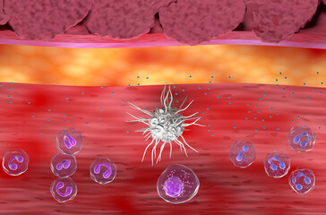 Inflammatory skin in Eczema, Atopic Dermatitis (AD) - top view 3d illustration - obrazy, fototapety, plakaty