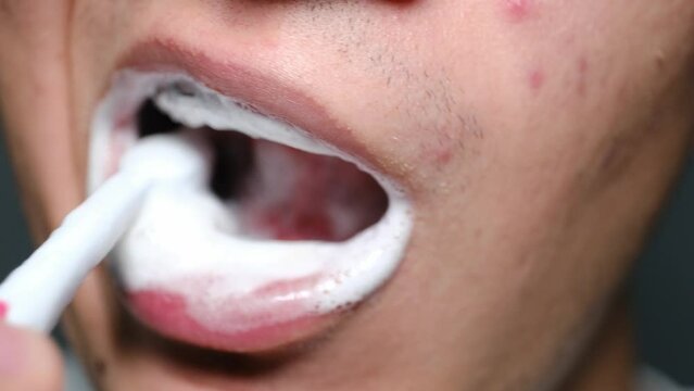 man with braces brushing his teeth macro shot