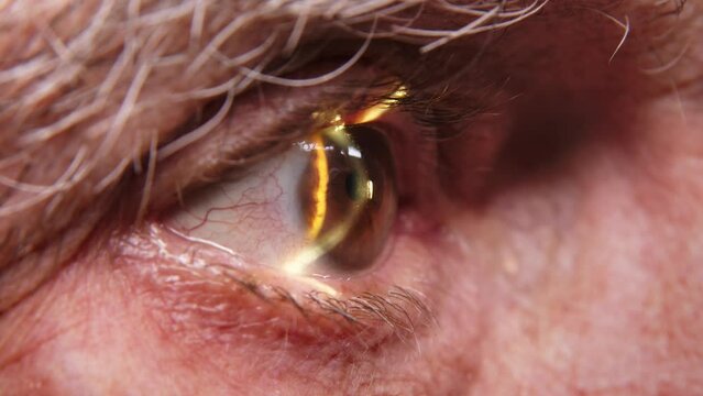 Close-up of a senior man having his vision tested on an ophthalmology diagnostic vision testing equipment. Old man doing eye test with non contact tonometer, checking vision at optical clinic