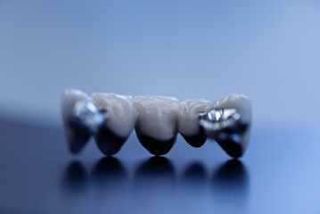 Dental teeth dentists model. Models of human jaws in an orthodontic clinic