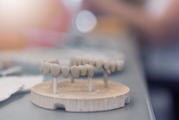 Dental teeth dentists model. Models of human jaws in an orthodontic clinic