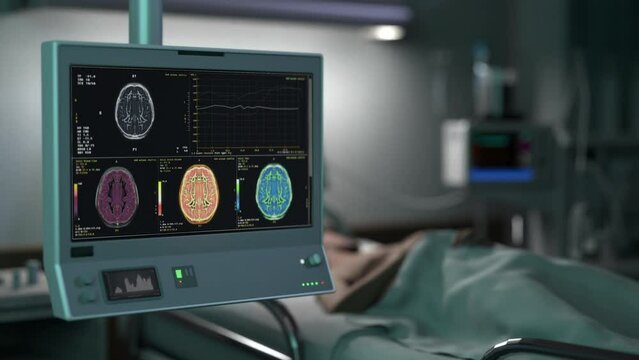 Medical examination scanner studying patients skull for injury treatment. Examination of the skull organs during brain injury treatment procedure. Examination of the head in the injury therapy ward.