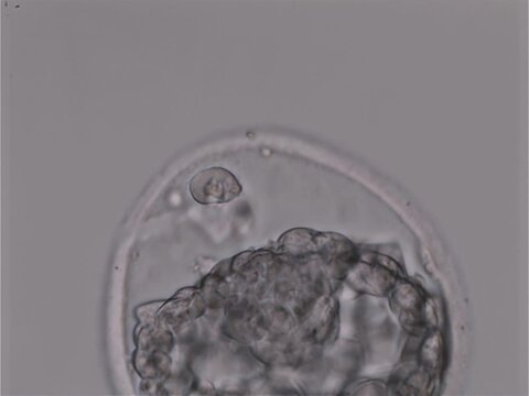 Embryo breaking out of outer layer in the female egg for the ivf embryo hatching process. Performing the ivf embryo hatching on patient. Assisted ivf embryo hatching procedure for women health