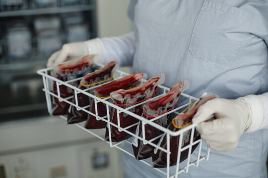 Hands of healthcare worker holding rack of blood bags