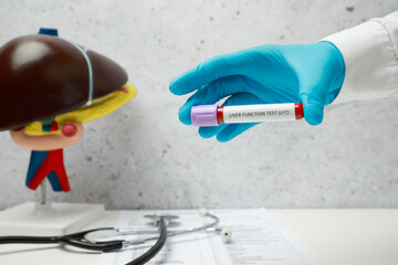 Laboratory worker holding tube with blood sample and label Liver Function Test over table, closeup....