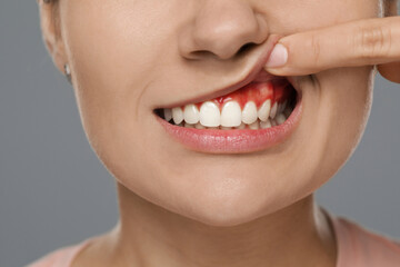 Woman showing inflamed gum on grey background, closeup