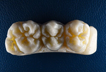 carved tooth on soap by dental assistant 