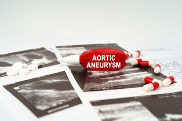 On the ultrasound pictures there are pills and a pen with the inscription - Aortic aneurysm