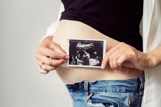 Pregnant woman holding ultrasound baby image. Pregnant belly and sonogram photo in hands of mother. Concept of pregnancy, gynecology, medical test, maternal health.