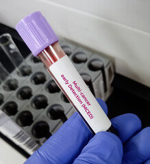 Blood sample for Multi-cancer Early Detection (MCED) Test. Galleri blood test.