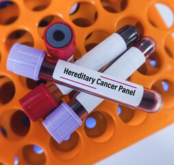 Scientist holding blood sample for hereditary cancer panel(HCP) test to diagnose hereditary cancer...