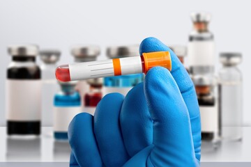 Blood sample for test in laboratory in doctor hands