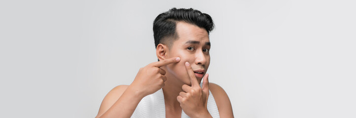 Handsome man touching his face. Squeezing pimple. - obrazy, fototapety, plakaty