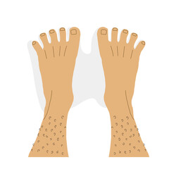 Cartoon illustration of pair of bare feet with normal healthy posture of toes. Male feet top view.