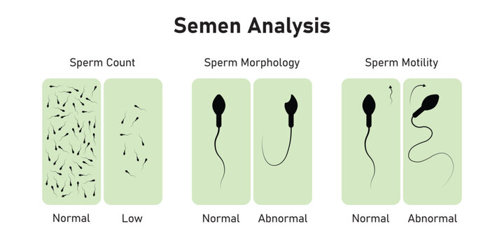 Semen Analysis Scientific Design. Vector Illustration.