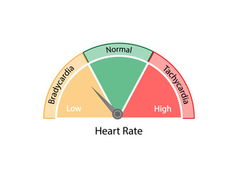 Heart rate, rhythm of the heart. Tachycardia and Bradycardia. ECG, supraventricular tachycardia and sinus bradycardia. Ventricular fibrillation. Arrhythmia. Vector illustration.