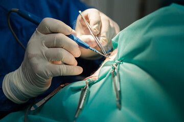 Surgeon's hands performing a surgical intervention with electro scalpel. Concept: medicine, health...