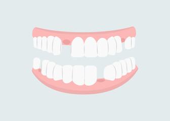 Mouth with teeth concept. Oral hygiene and cleanliness, stomatology. Problems with teeth. Health care and treatment. Poster or banner. Cartoon flat vector illustration isolated on grey background