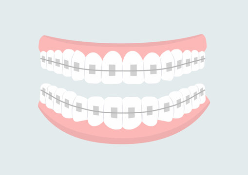 Mouth with teeth concept. Oral hygiene and cleanliness, stomatology. Mouth with braces. Diagnosis and treatment. Cover or banner. Cartoon flat vector illustration isolated on grey background