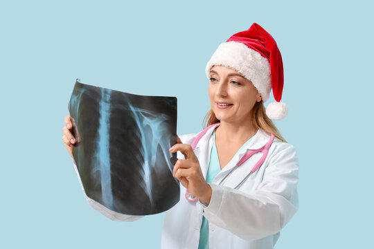 Mature female doctor in Santa hat with x-ray image on blue background