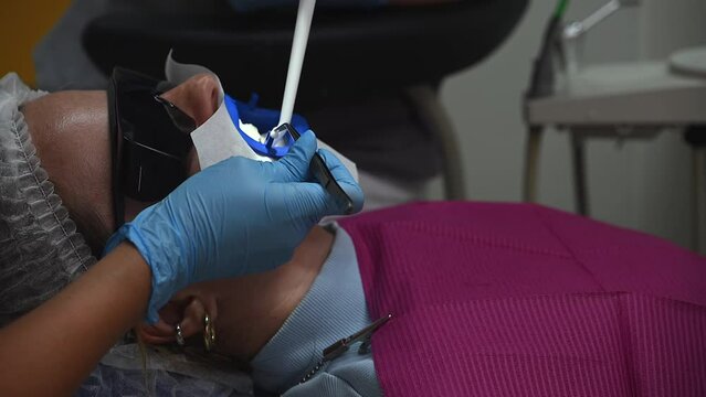 Dental Whitening process in patient mouth. Teeth whitening with UF Lamp, Led Lamp and gel. Dental Extreme Close up Macro Video. Concept of professional dental hygiene. 4k 120 fps slow motion footage