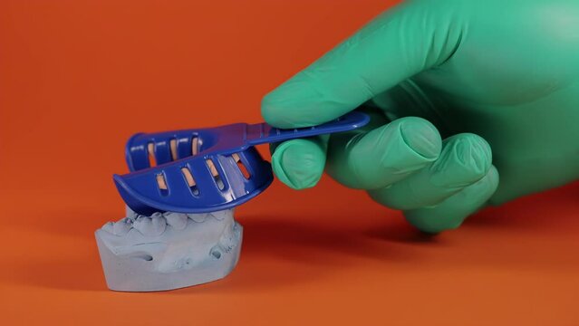 The hand of an orthopedic dentist doctor makes an impression of the patient s dental jaw using an impression medical spoon. Manufacturing of patient's false jaws and dental crowns. Malocclusion. Slow