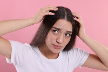 Emotional woman suffering from dandruff problem on pink background