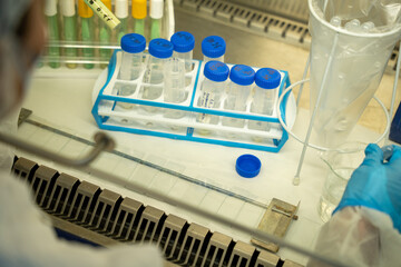 collector samples are transferred to glass slides to see in microscope