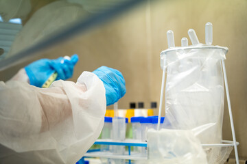 highly complicated Laboratory sample analysis in tuberculosis Department