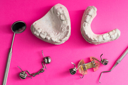 Dental casting gypsum model of human jaws. Crooked teeth and distal bite. plate for the tooth