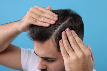 Man examining his head on light blue background, closeup. Dandruff problem