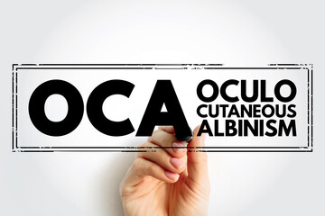 OCA Oculocutaneous Albinism - genetic disorder characterized by skin, hair, and eye hypopigmentation due to a reduction or absence of melanin, acronym text stamp concept background - obrazy, fototapety, plakaty